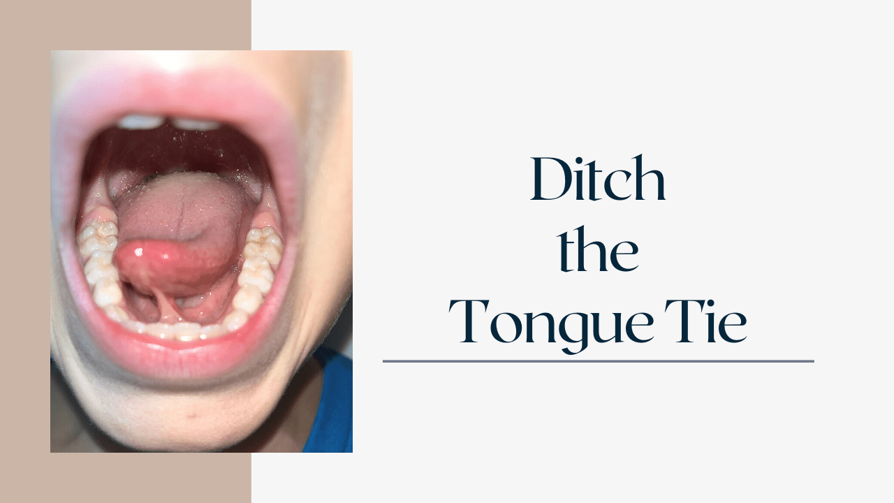 Ditch The Tongue Tie Impact Myofunctional Therapy