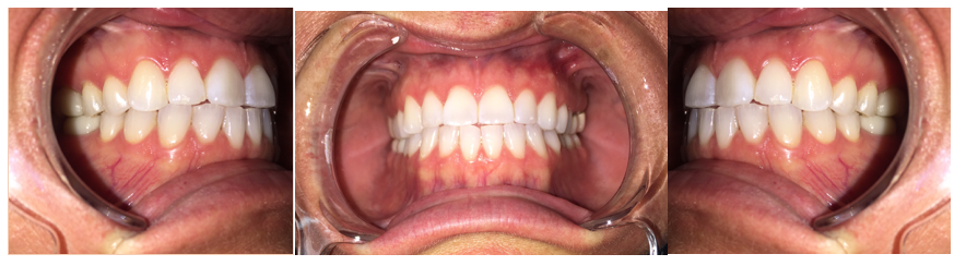 comprehensive myofunctional exam of occlusion